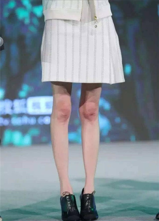 鞠婧祎的腿型就属于这种最理想腿型,所以不论她的腿长到底有多少,由于